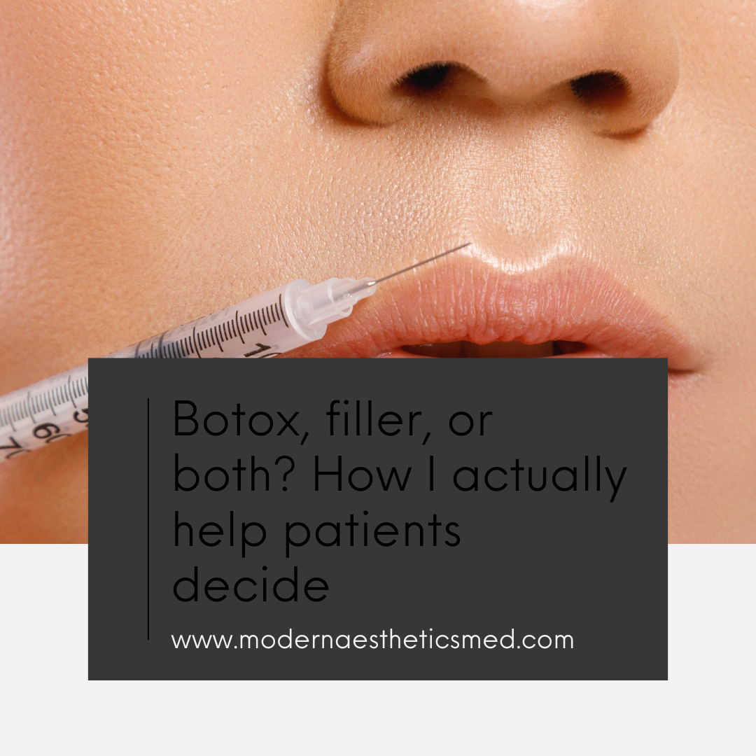 Botox, filler, or both? How I actually help patients decide