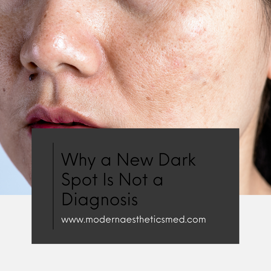 Why a New Dark Spot Is Not a Diagnosis