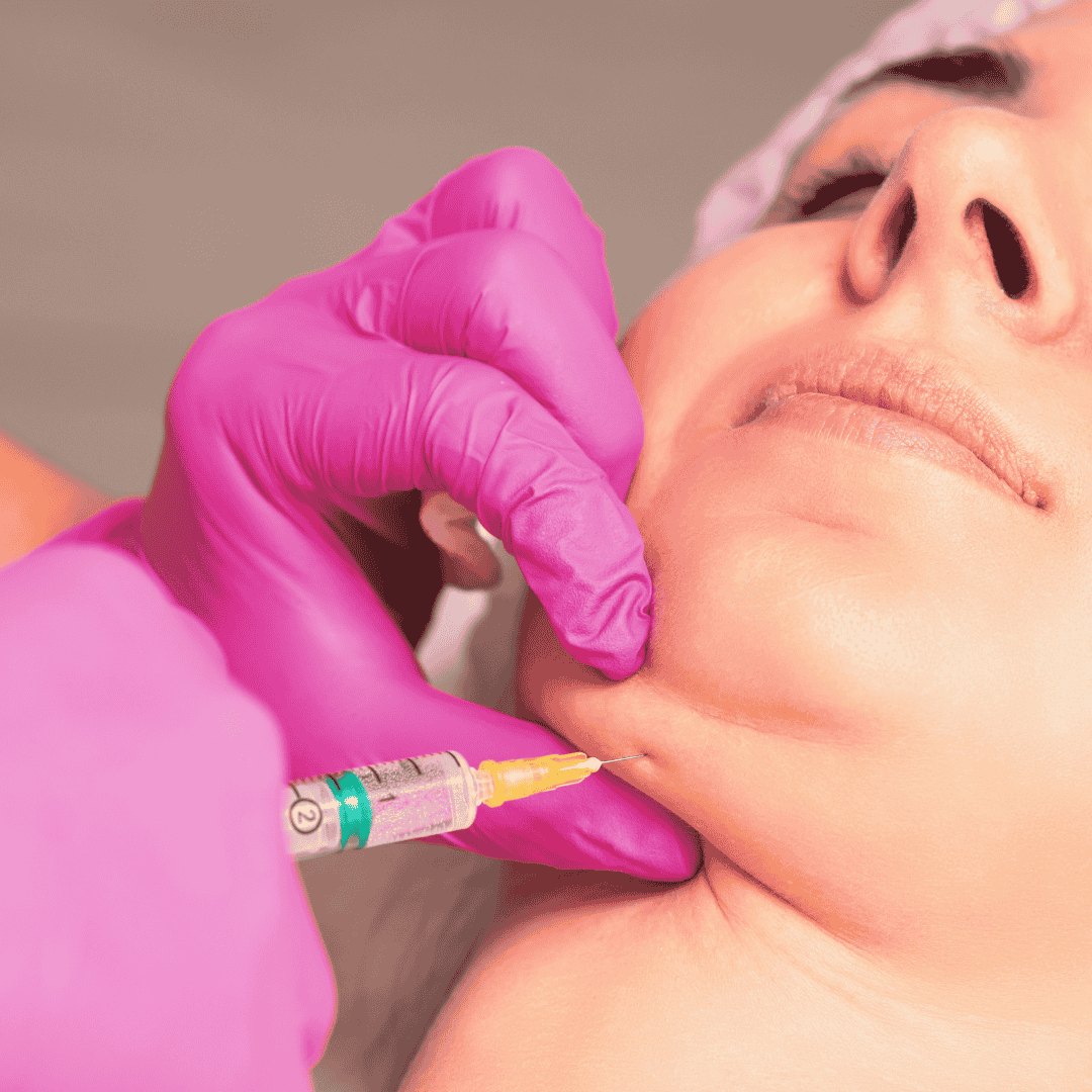 Kybella injection