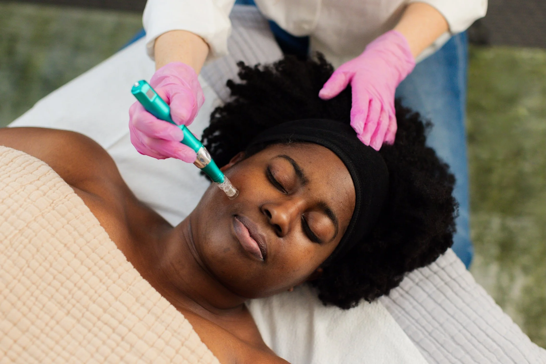 woman getting microneedling service