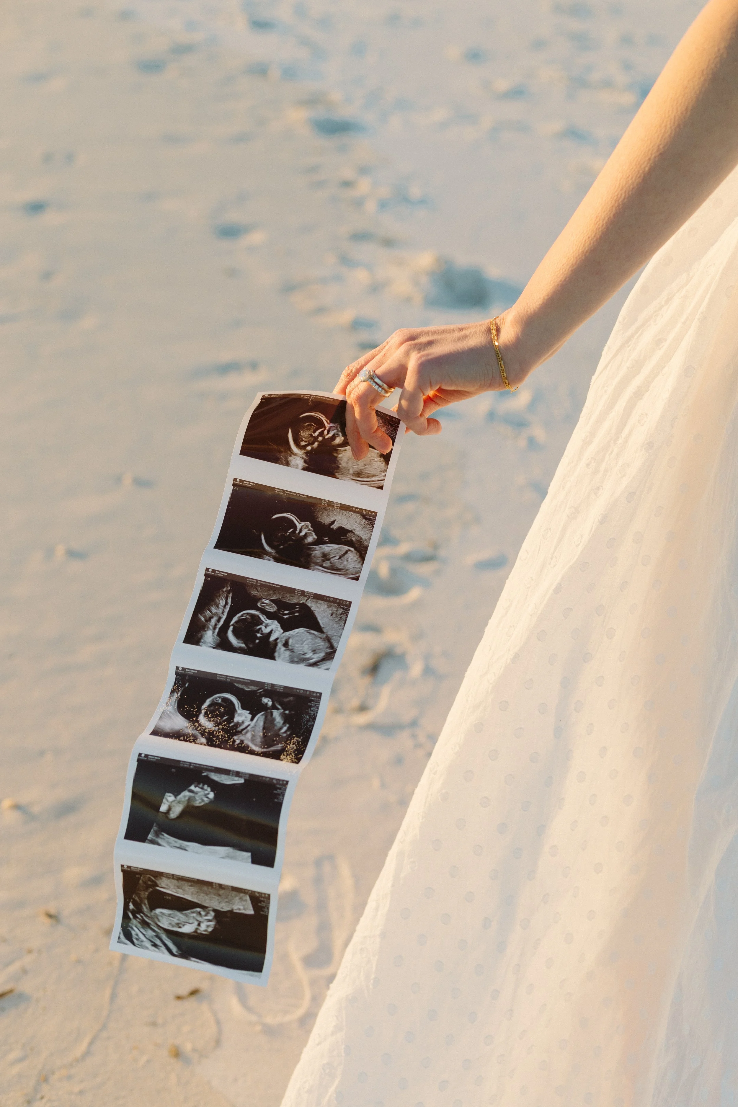 A woman in a white dress is holding a strip of six ultrasound images of a developing fetus on a sandy beach during sunset.