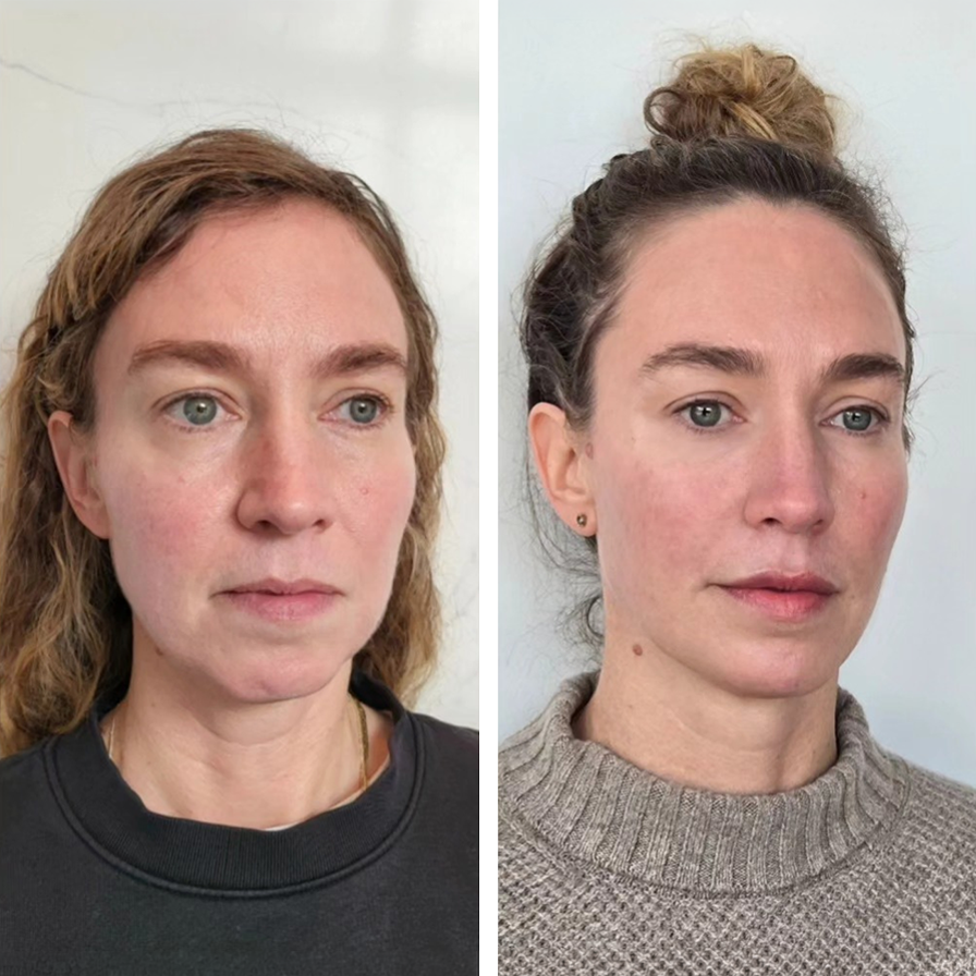 Side-by-side comparison of two women with clear skin, one with wavy red hair and the other with curly brown hair in a bun, both against plain backgrounds.