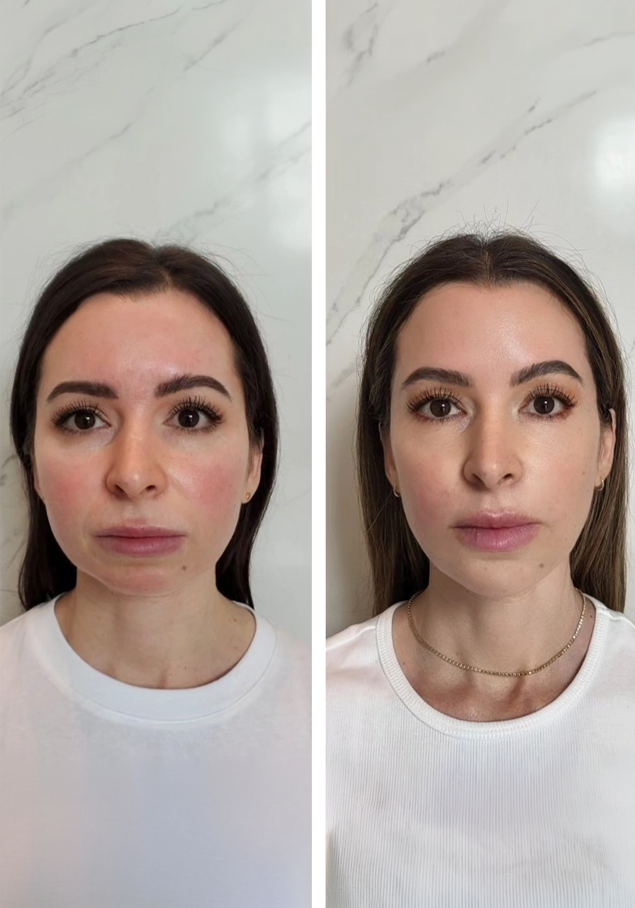 Side-by-side before and after photos of a woman with makeup removal and facial treatment, showing clearer skin and natural look in the after image.