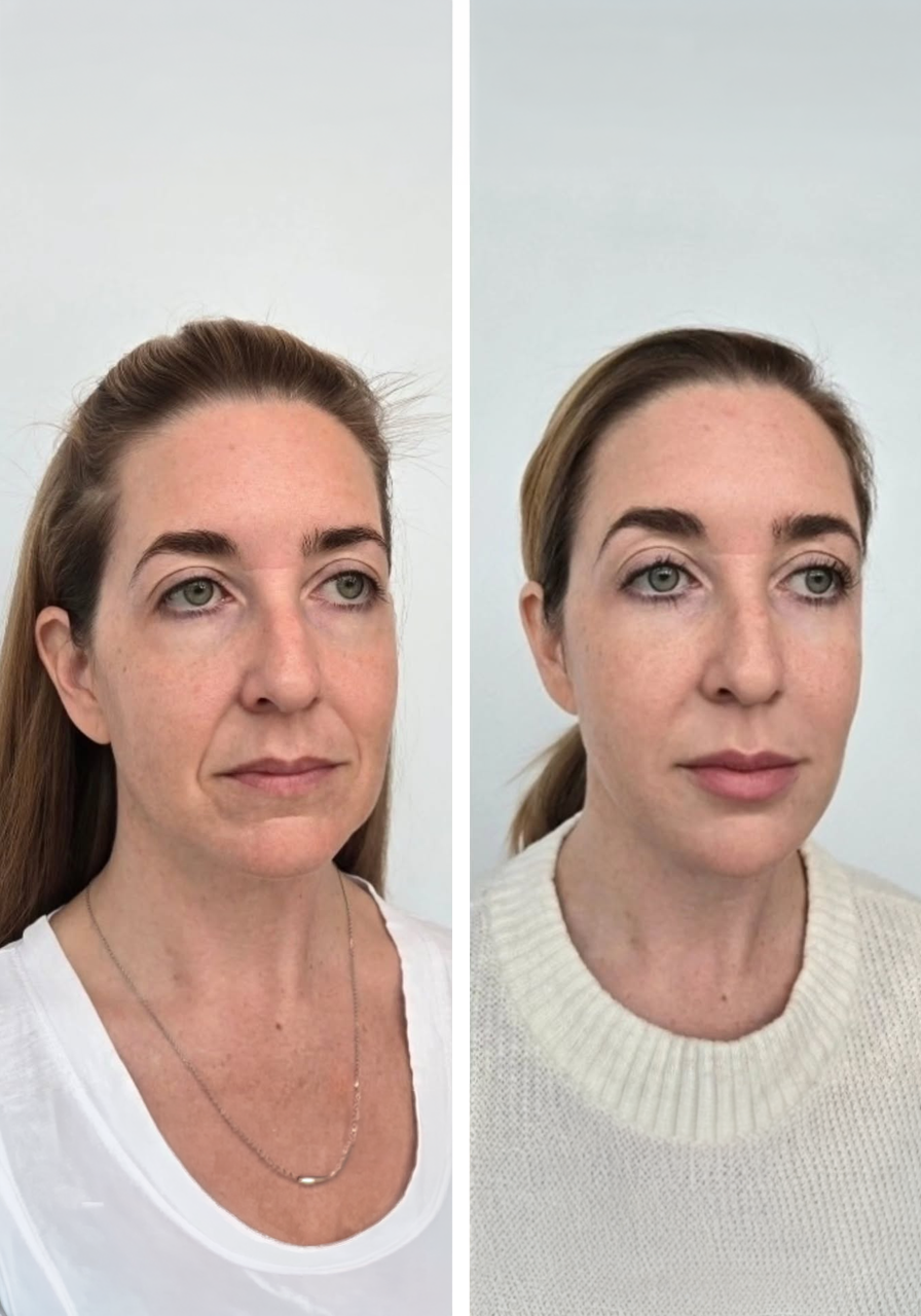 Comparison of a woman's face before and after skincare or makeup application, with the left side showing a natural look and the right side showing a more polished appearance.