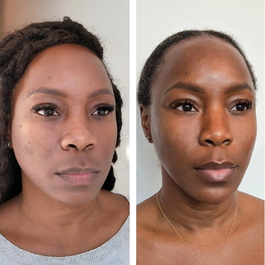 Side-by-side comparison of a woman before and after skincare, showing improved skin clarity and texture.