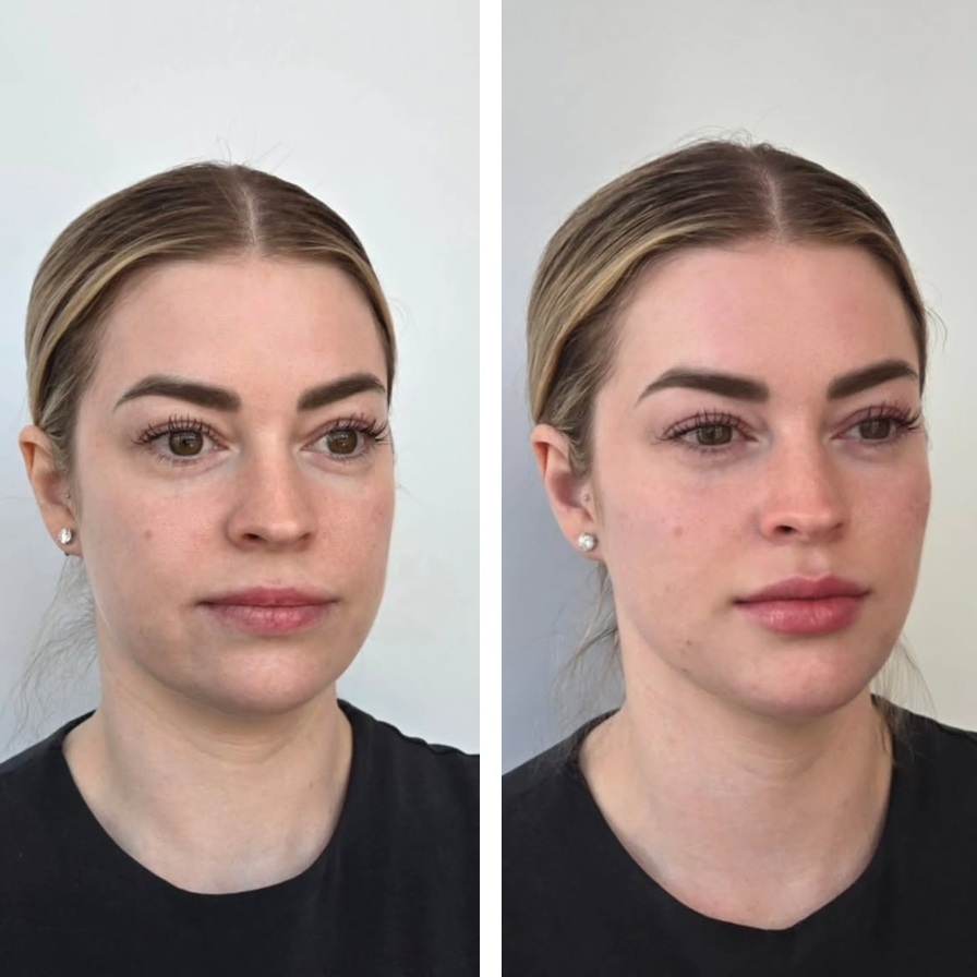 Side-by-side images of a woman with blonde hair, showing her face before and after skincare or makeup application, both wearing black shirts and earrings.