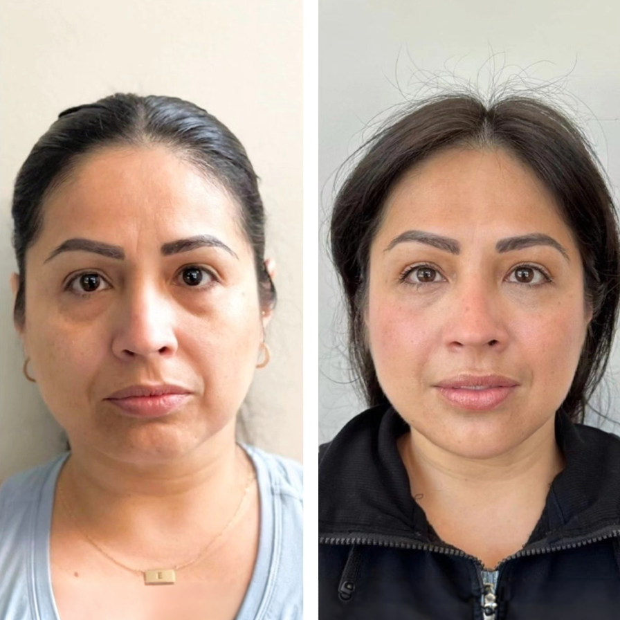 Before and after comparison photos of a woman with makeup and skincare treatment, showing improved skin tone and texture.