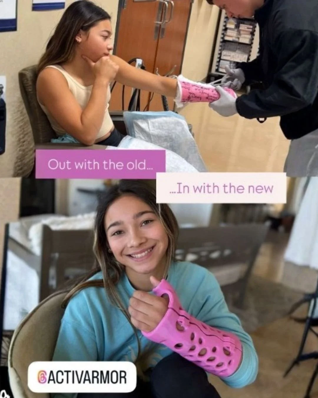 "My daughter likes that she now has no problems scratching underneath the cast." Michelle (mom)
Parker is a gymnast in California. She incurred a Buckle Fracture of her thumb while doing a skill (Bail) on bars & was offered the waterpr