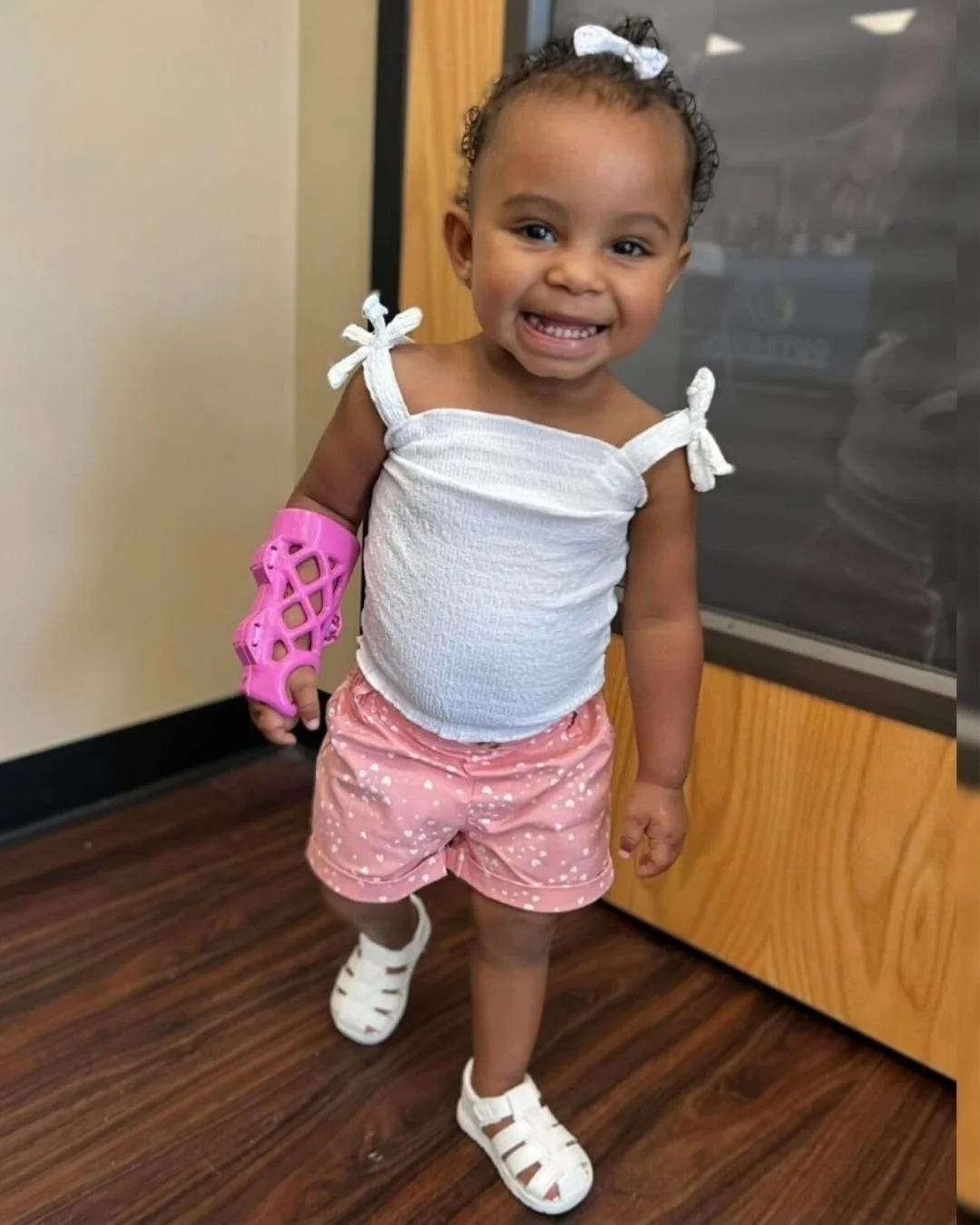 It's perfect for tiny patients too + No More Stinky Casts! 
Goodbye, uncomfortable & unhygienic traditional casts! ActivArmor custom 3D Printed casts for infants, offering superior comfort, a waterproof, sanitizable, & lightweight design, an
