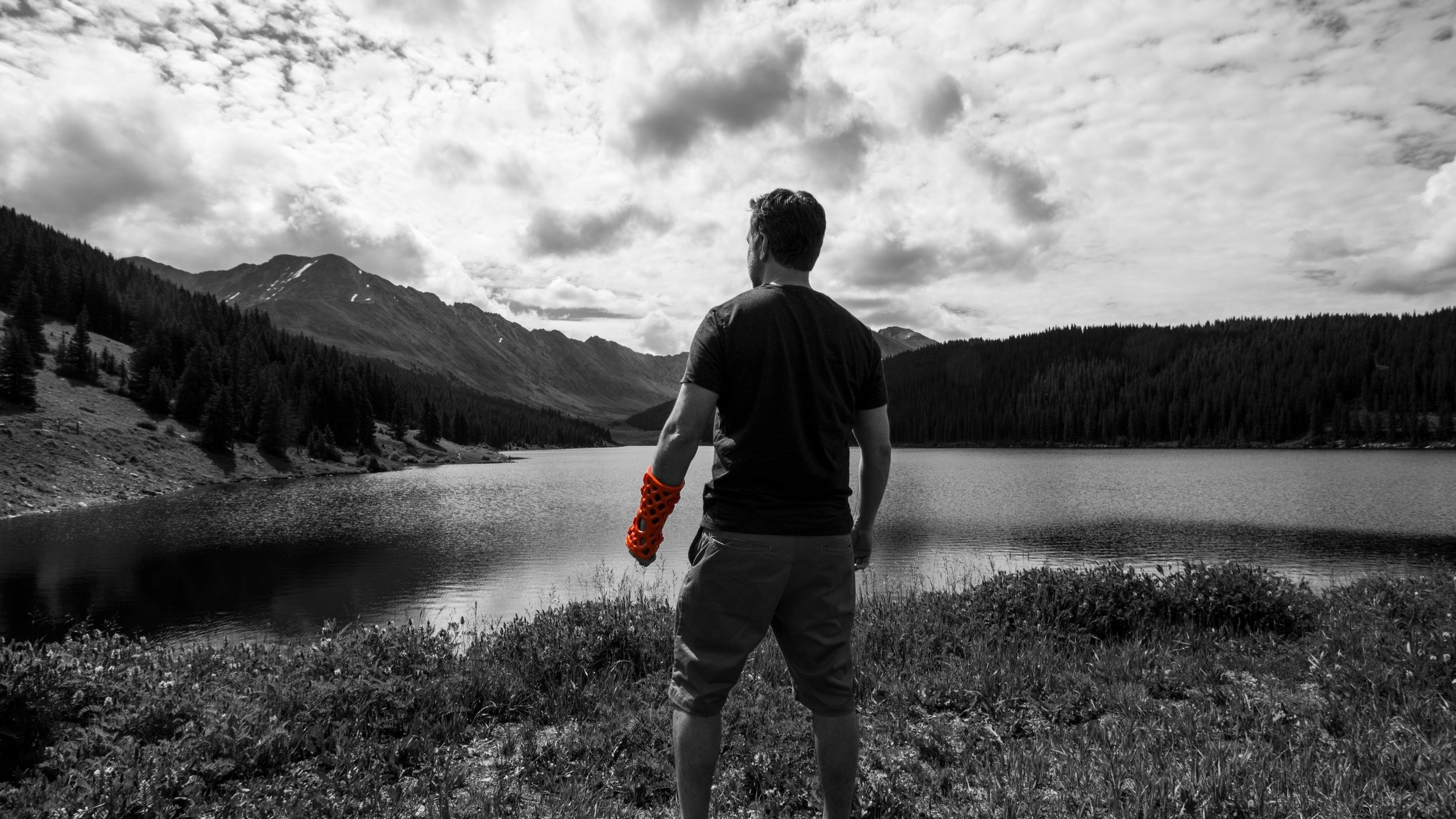 Activarmor custom 3d printed casts and splints