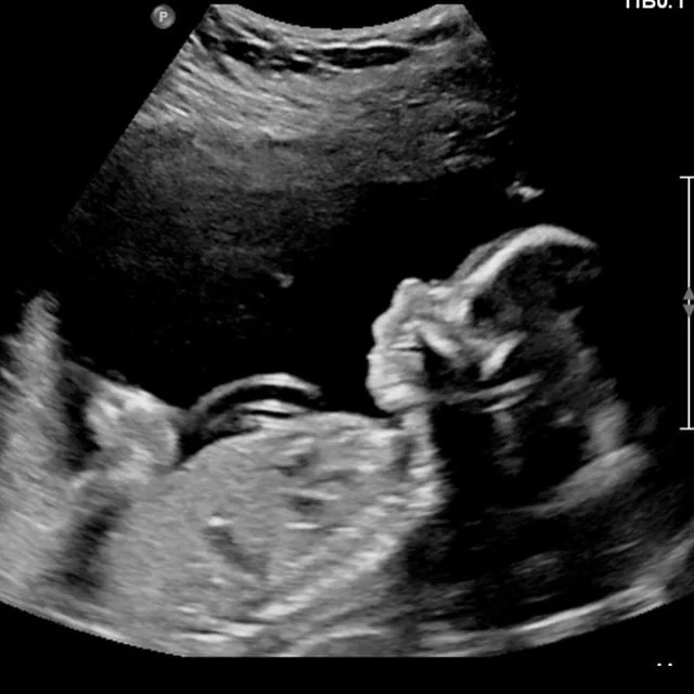 Jono &amp; I are so excited to announce our little princess due in July 24&rsquo; 🙈💗🥰

She is so loved already and we&rsquo;re so excited for this next chapter 🥹 

My books are officially closed from June - November ✨ all emails/DMs/enquiries wil