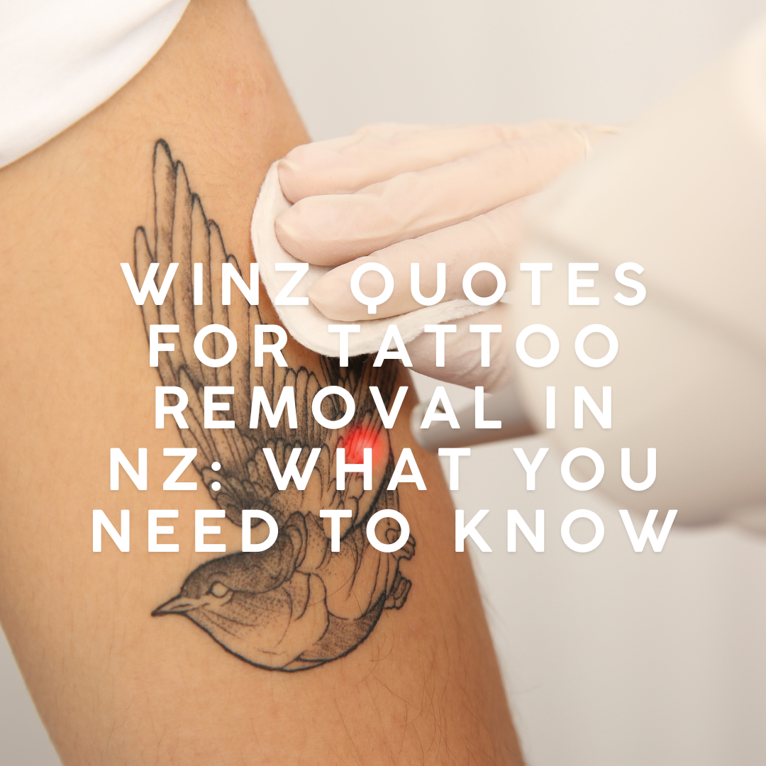 WINZ Quotes for Tattoo Removal in Papamoa, Tauranga: What You Need to Know