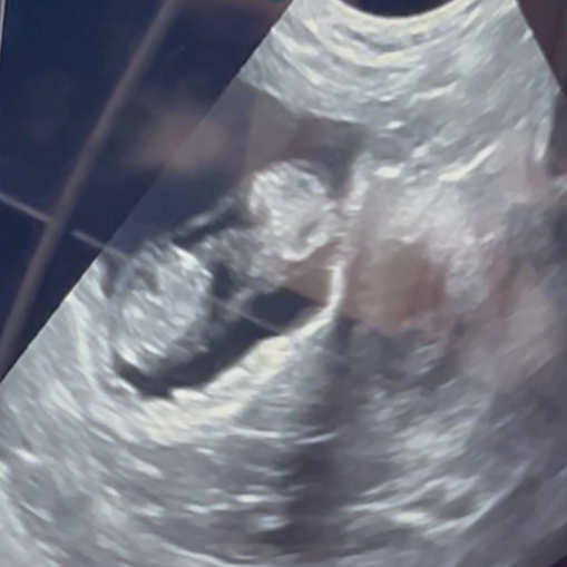 Screenshot 2026-03-12 at 9.39.57 PM.png