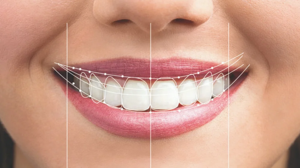 Refresh Your Smile — Lynwood Dental