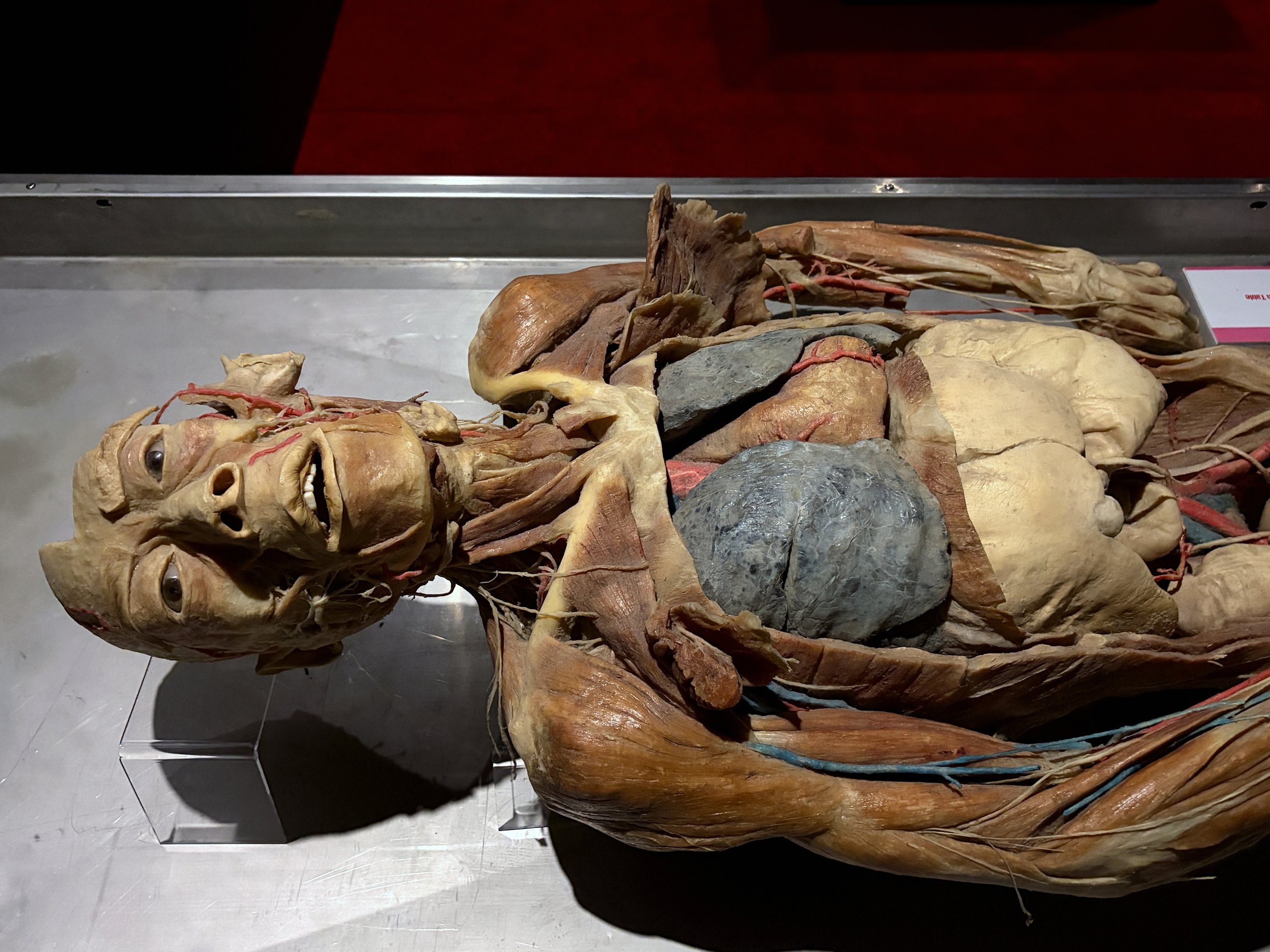 A preserved human body dissected to show muscles, bones, and internal organs, displayed in a museum setting.