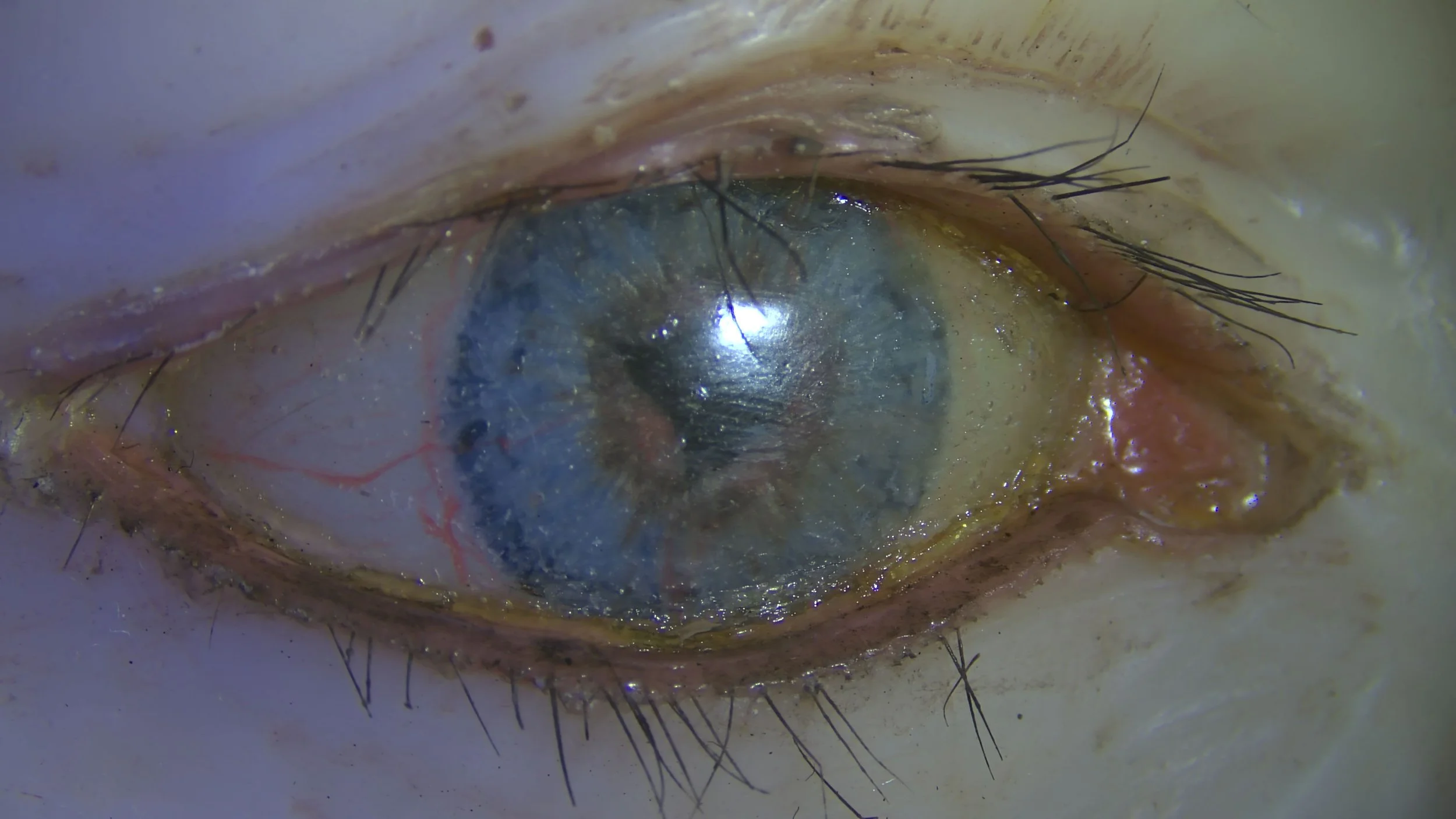 Fig. 6 Original eyelashes, during, raking light