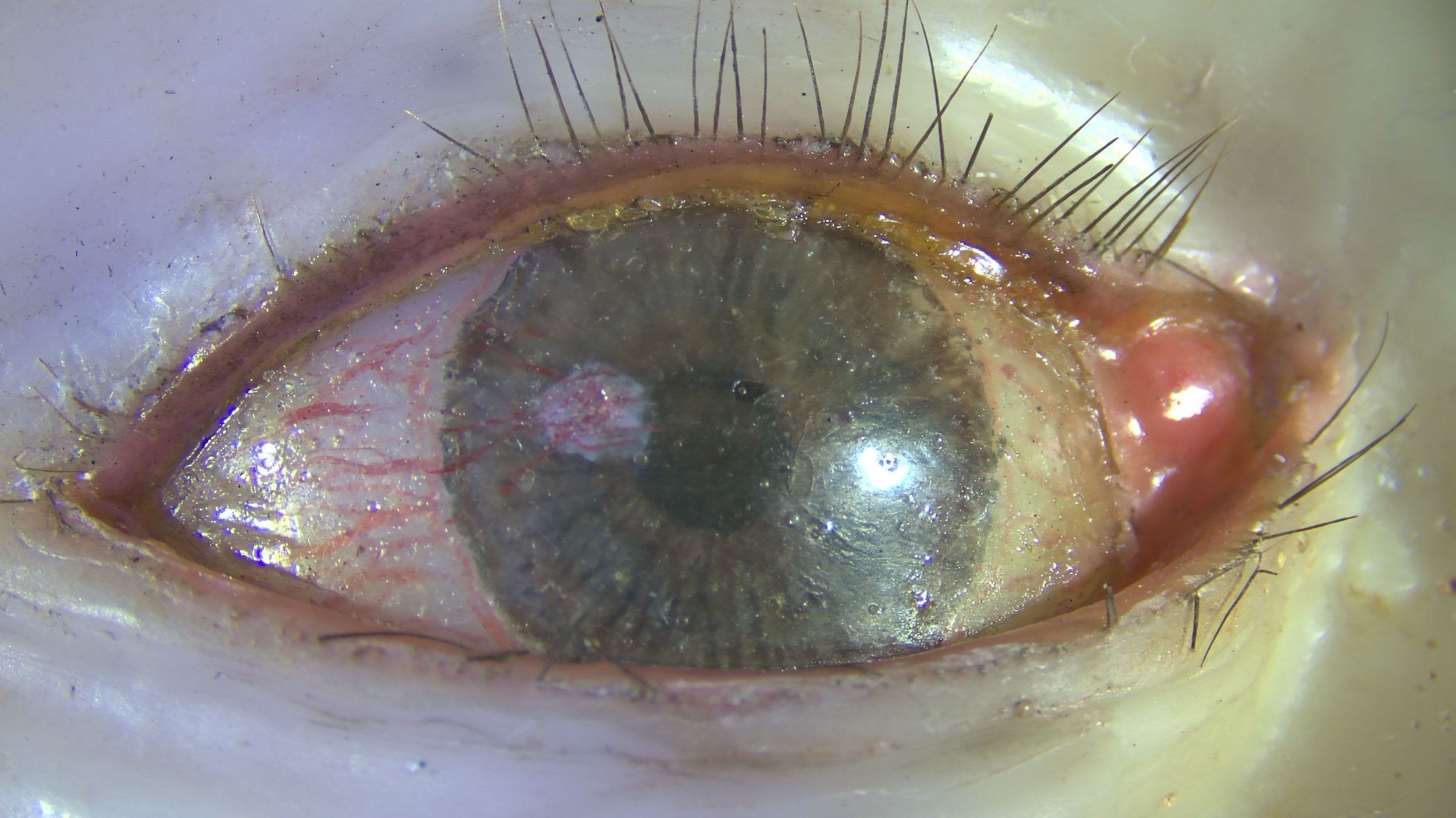 Fig. 5 Original eyelashes, during, normal light