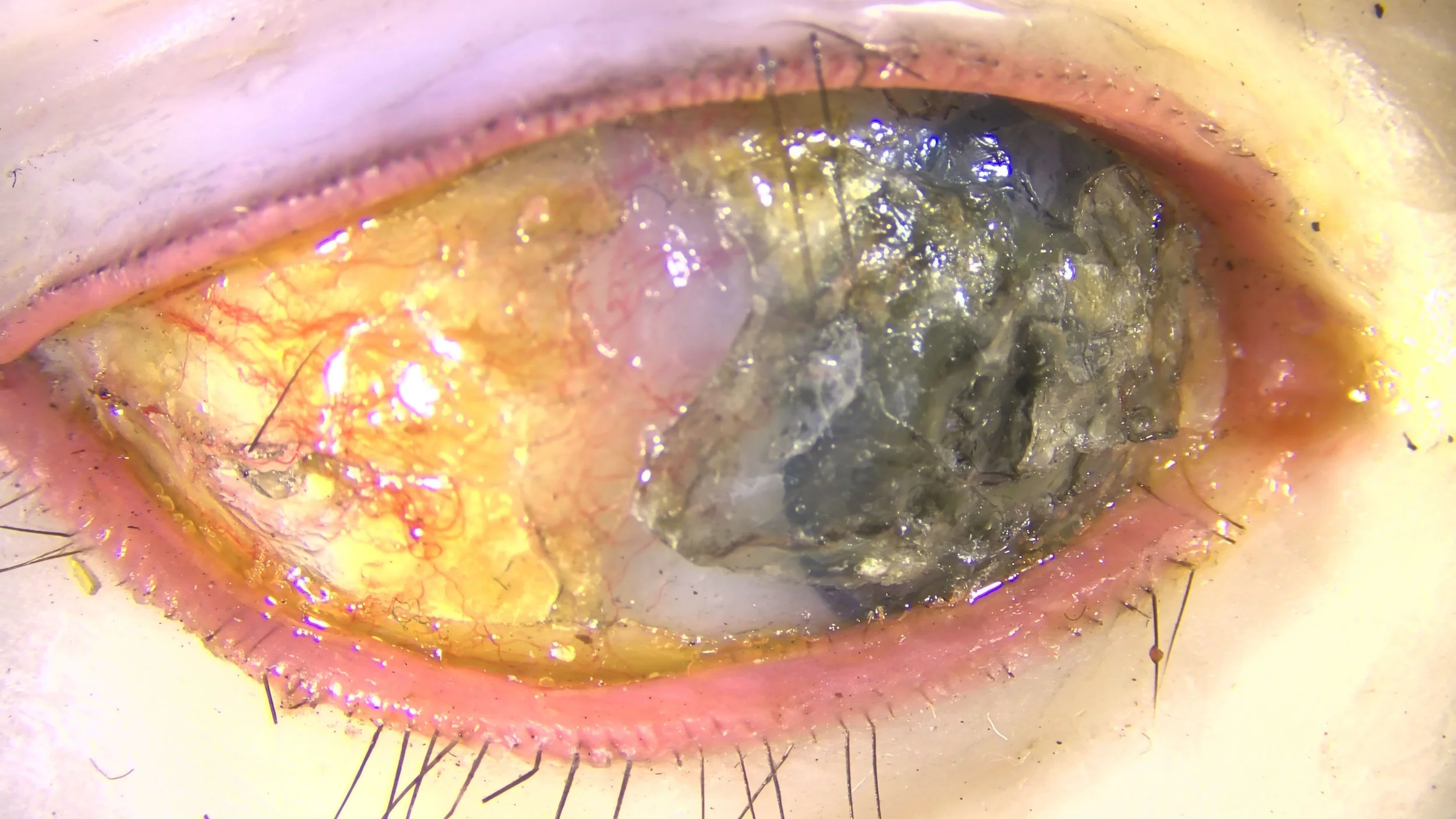 Fig. 9a before treatment, normal light