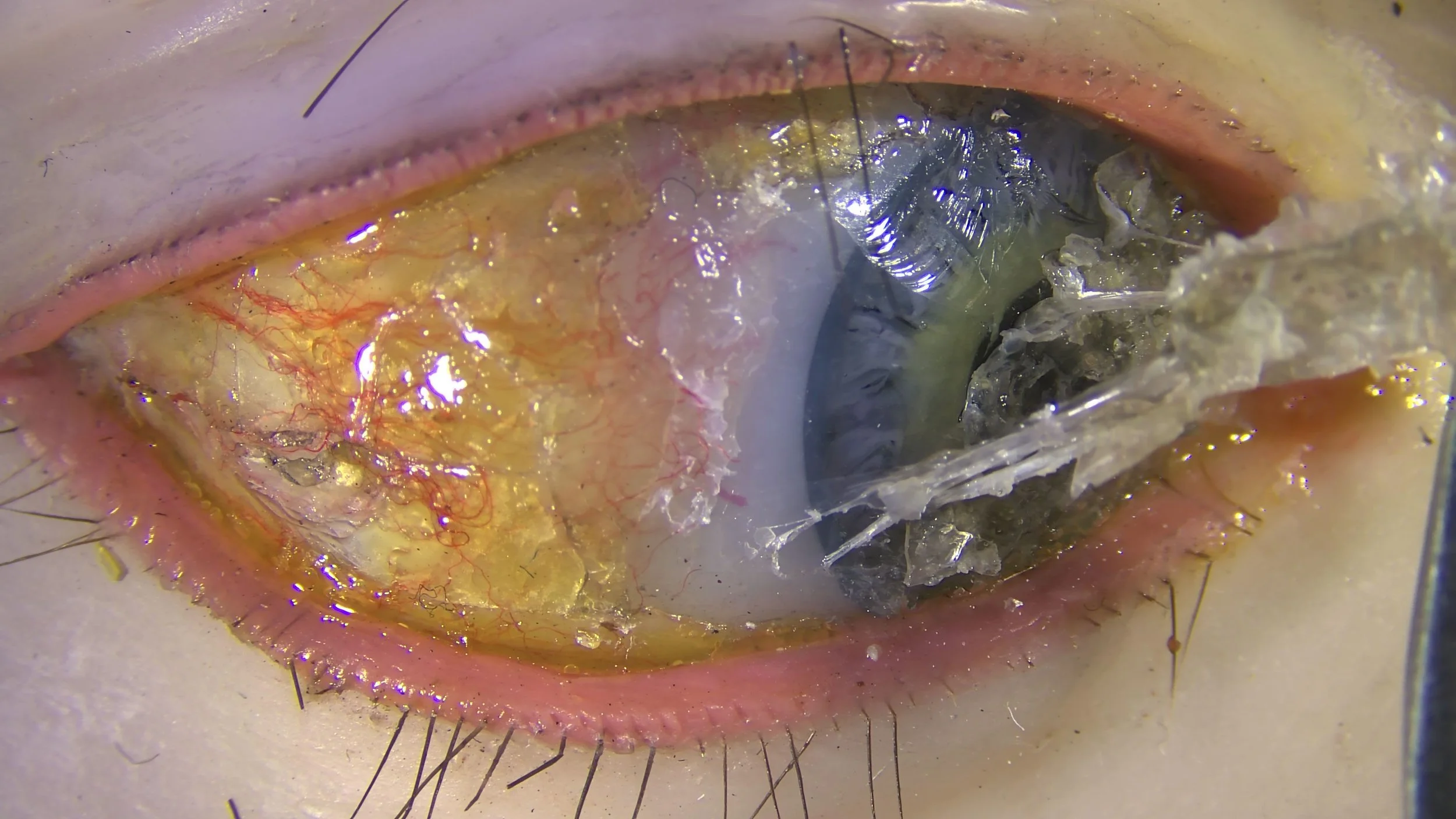 Fig. 9c during treatment, normal light
