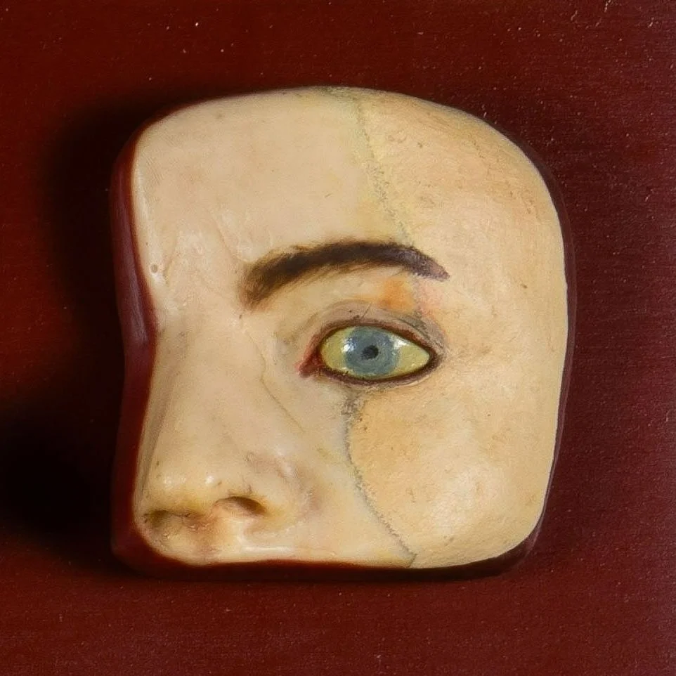 Fig 11a before treatment, normal light