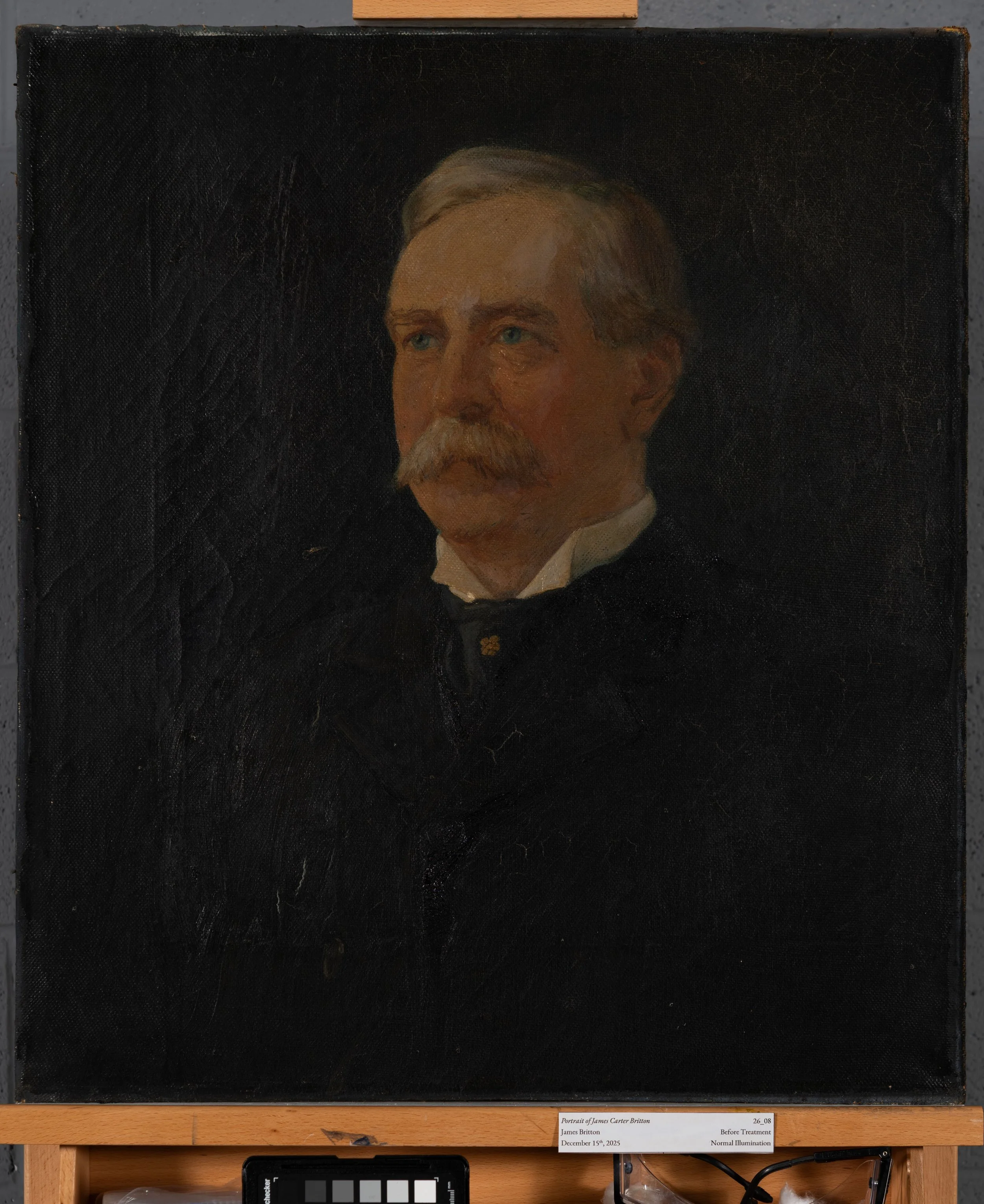 Before Treatment, Normal Illumination
