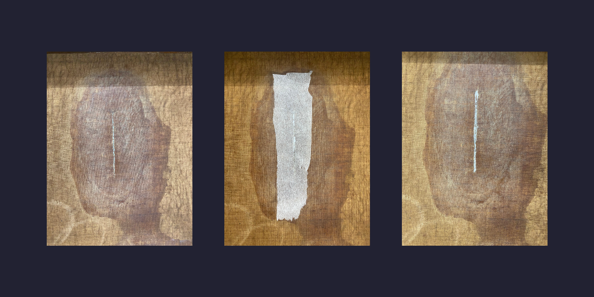 Before, during, and after pictures of a jade tissue mend of a tear.  The during photo shows the jade tissue placed over the tear on the face of the painting, which is then removed in the after except for what stays in the tear.
