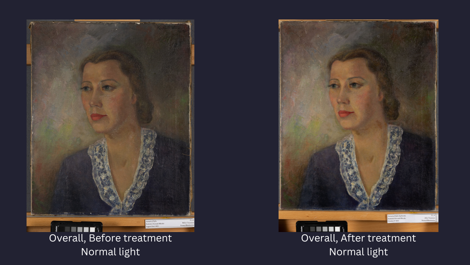 before and after treatment photography