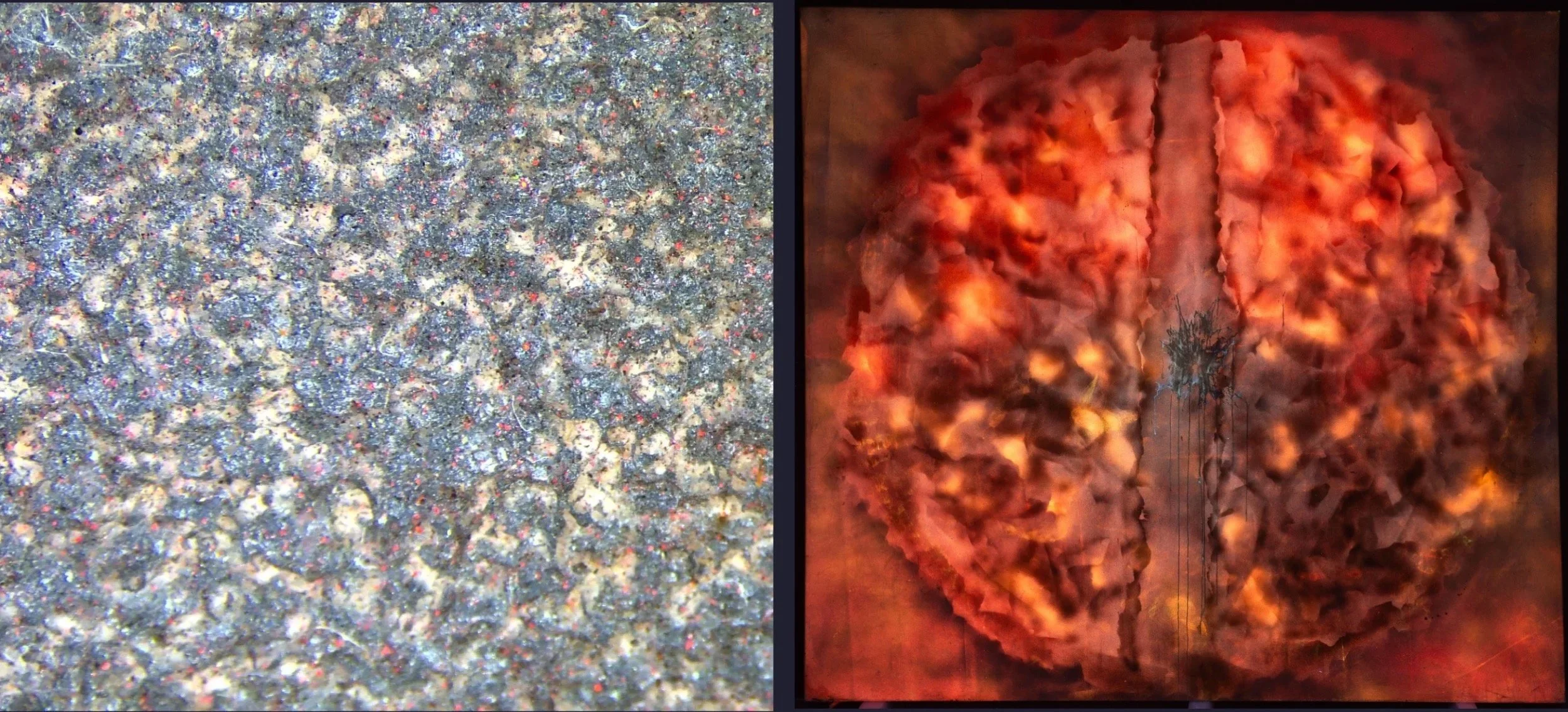 Left: Photomicrograph, 12.5x, normal light, before treatment; Right: Overall, UV light, before treatment