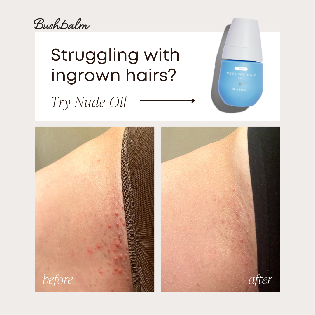 Advertisement for Bushbalm Nude Oil showing a before and after comparison of a person's underarm skin, highlighting improved skin condition after using the product.