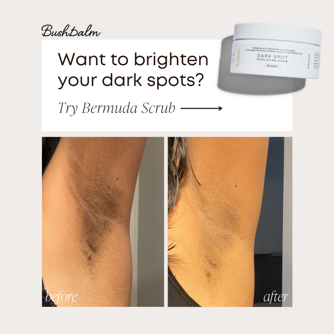 Advertisement for Bermuda Scrub showing a before and after comparison of underarm skin, highlighting removal of dark spots.