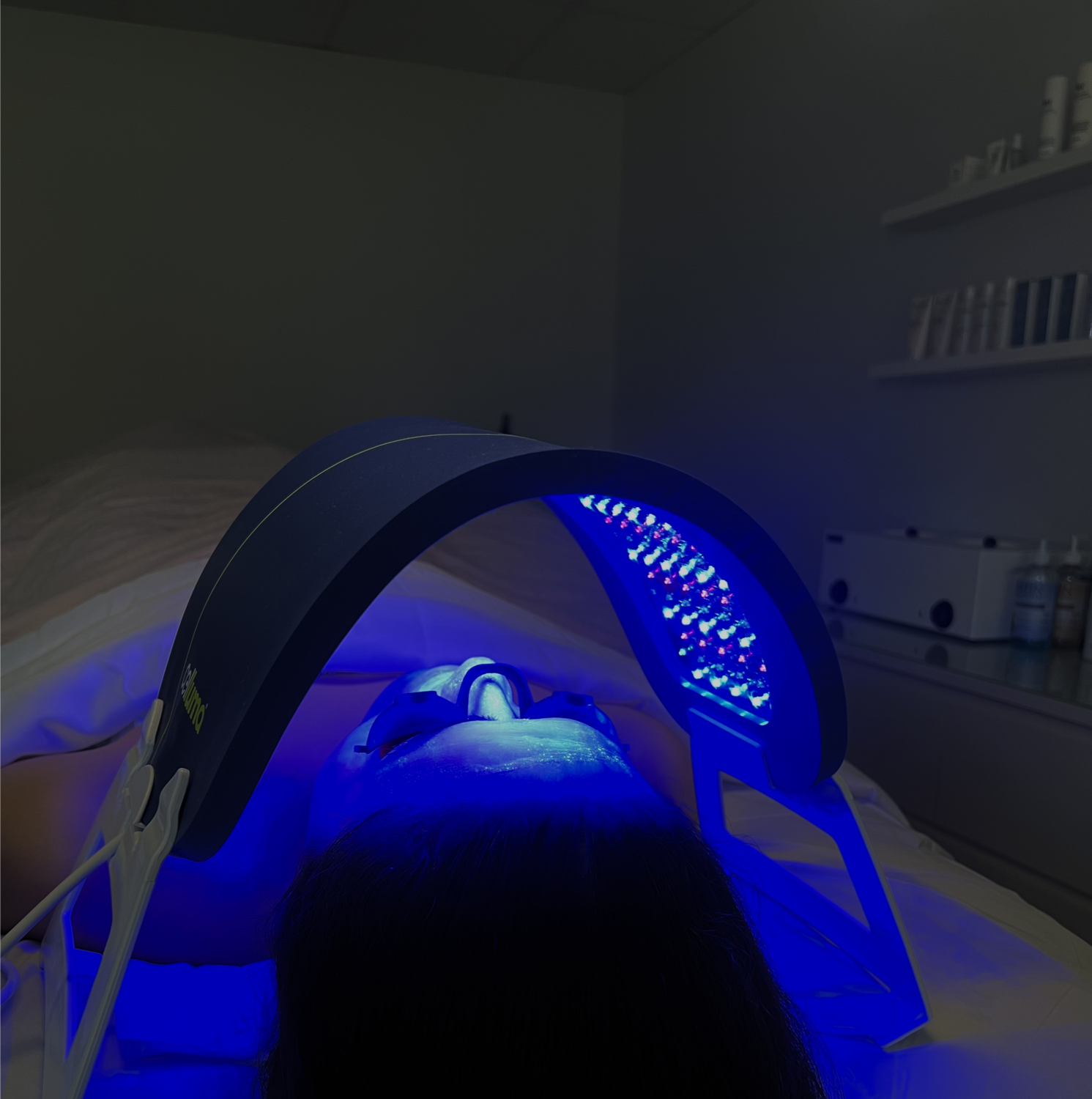 Patient undergoing a blue light therapy treatment while lying on a bed in a clinical setting.
