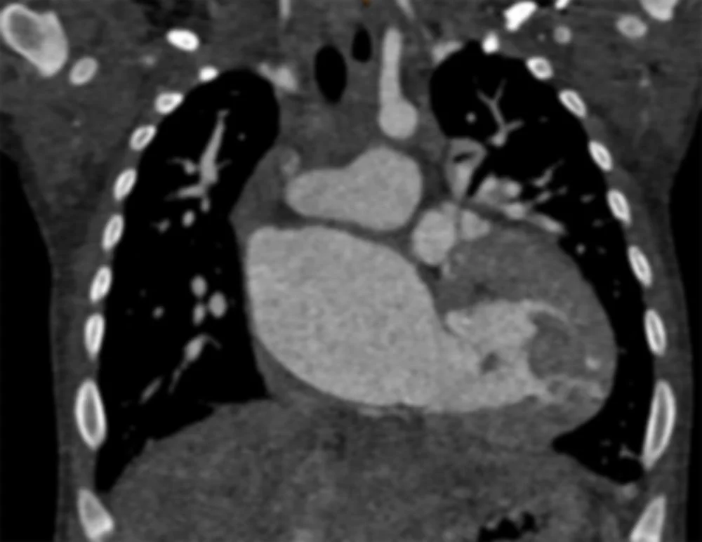 Pediatric Imaging — International Society of Forensic Radiology and Imaging