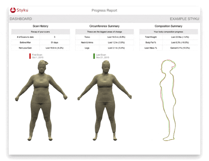 Progress report showing before and after 3D body scans with side profile outline on the right.