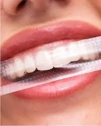 Comparing Teeth Whitening Methods: PAP+ vs. Hydrogen Peroxide