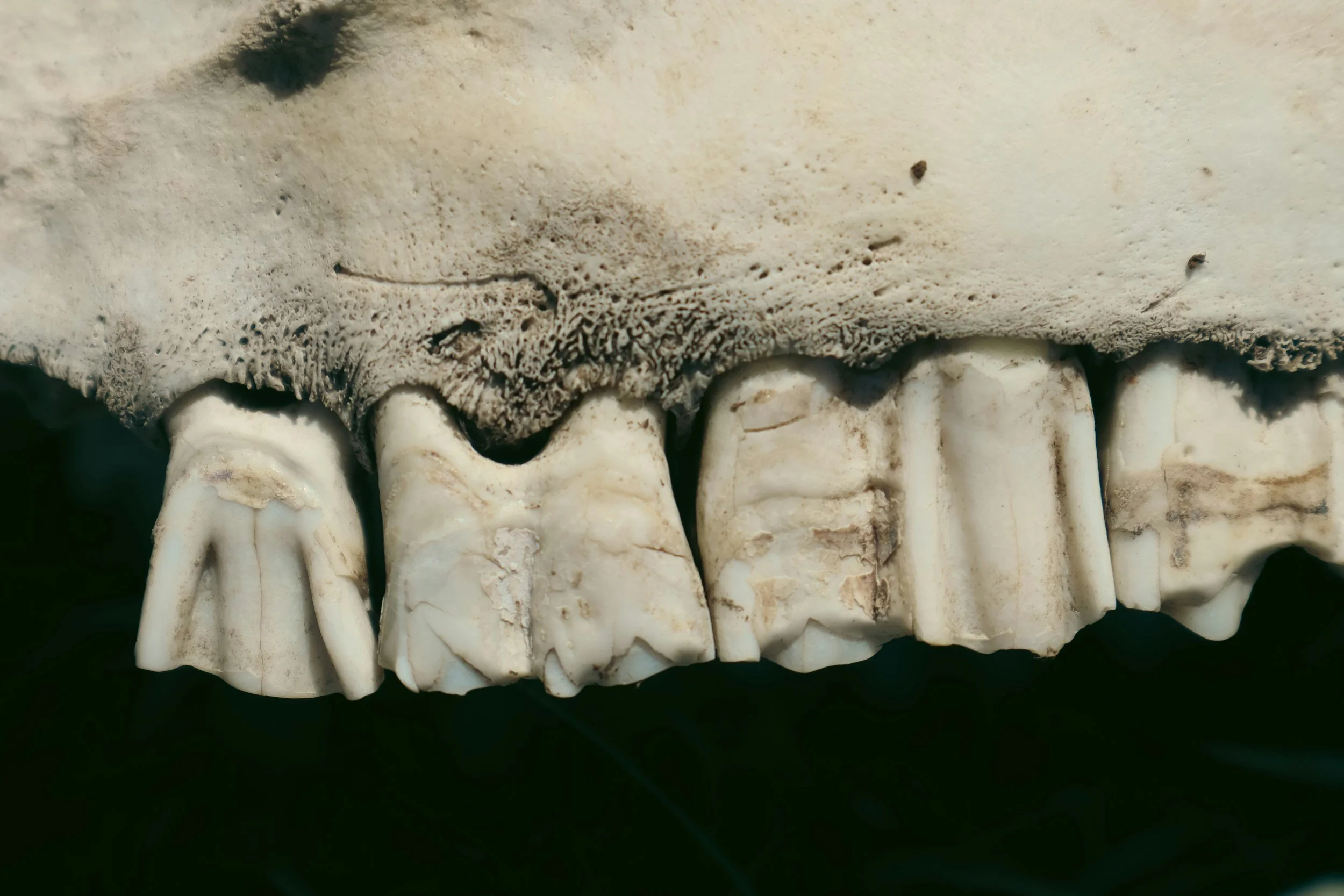 A Smoky Rise: Drug Use in Victoria and What It Means for Your Smile