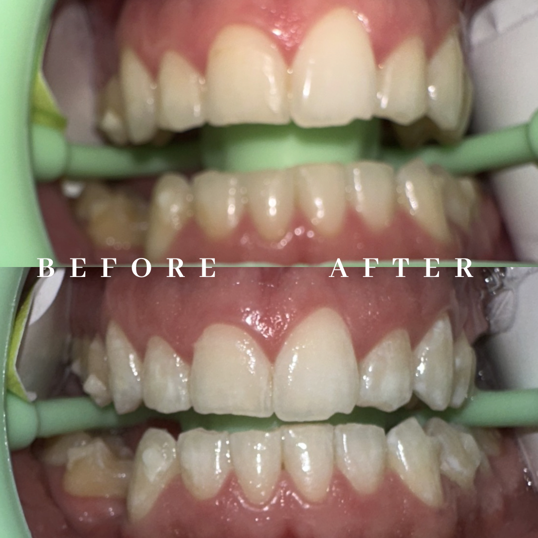 Copy of before & after - 2.png