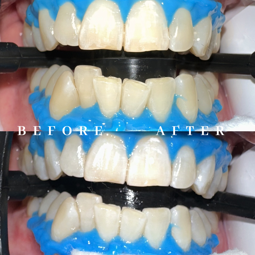 Copy of before & after.png