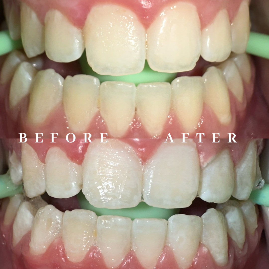 Copy of before & after.png