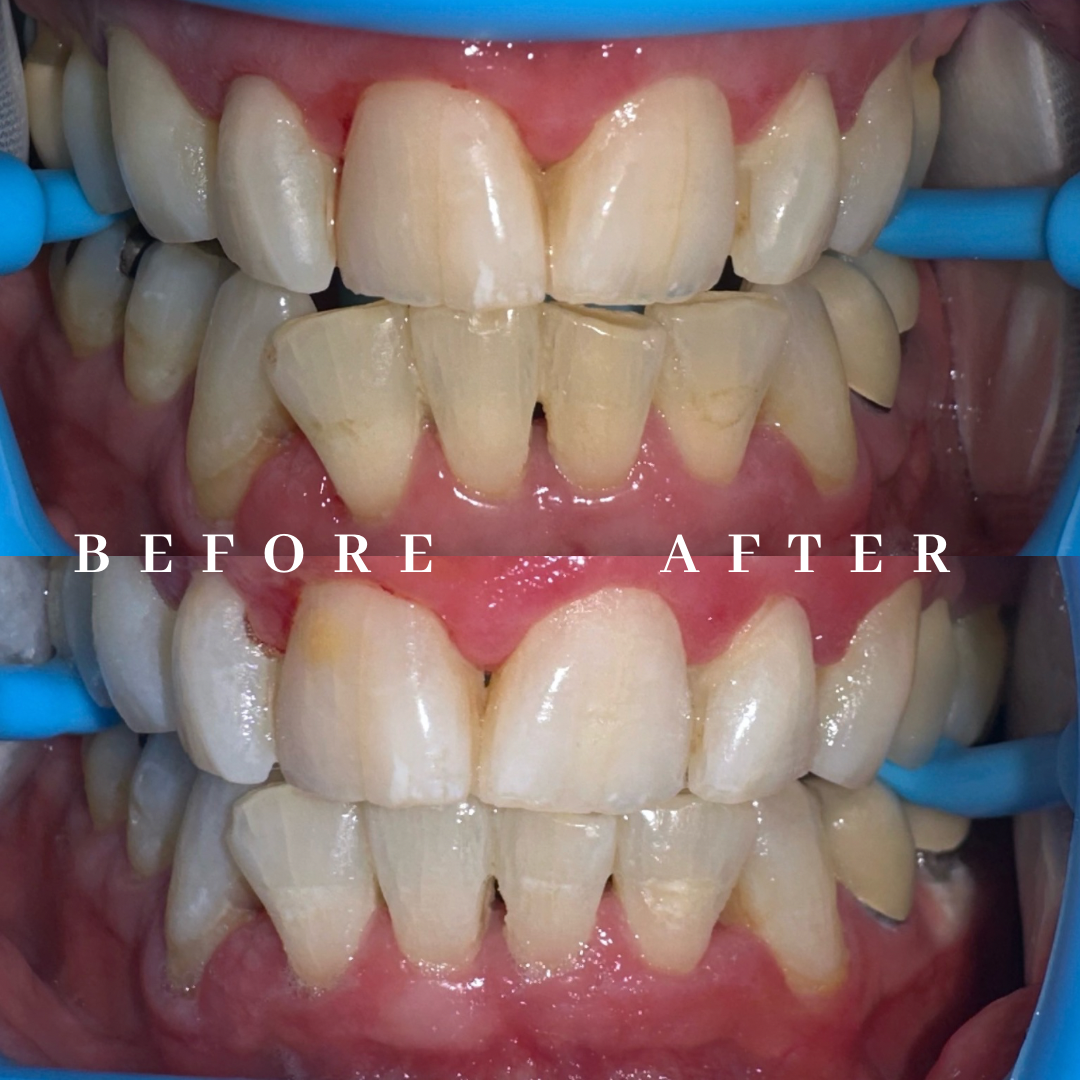 Copy of before & after - 1.png