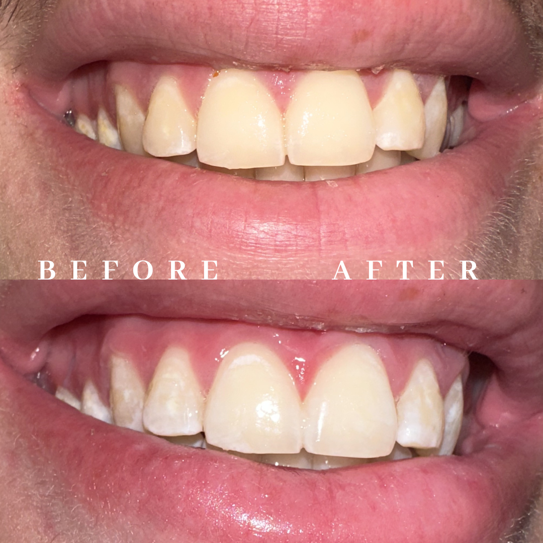 Copy of before & after - 1.png