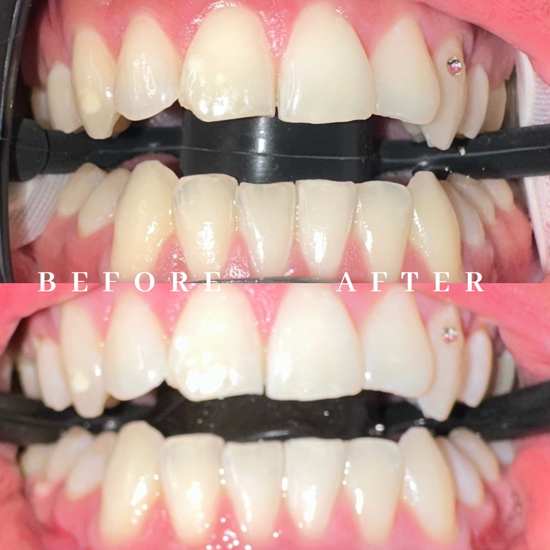 Copy of before & after.png