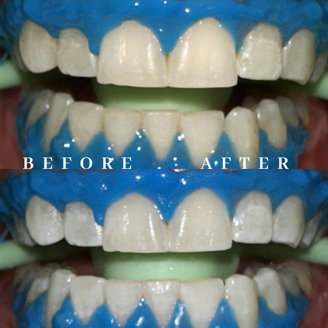 Copy of before & after.png