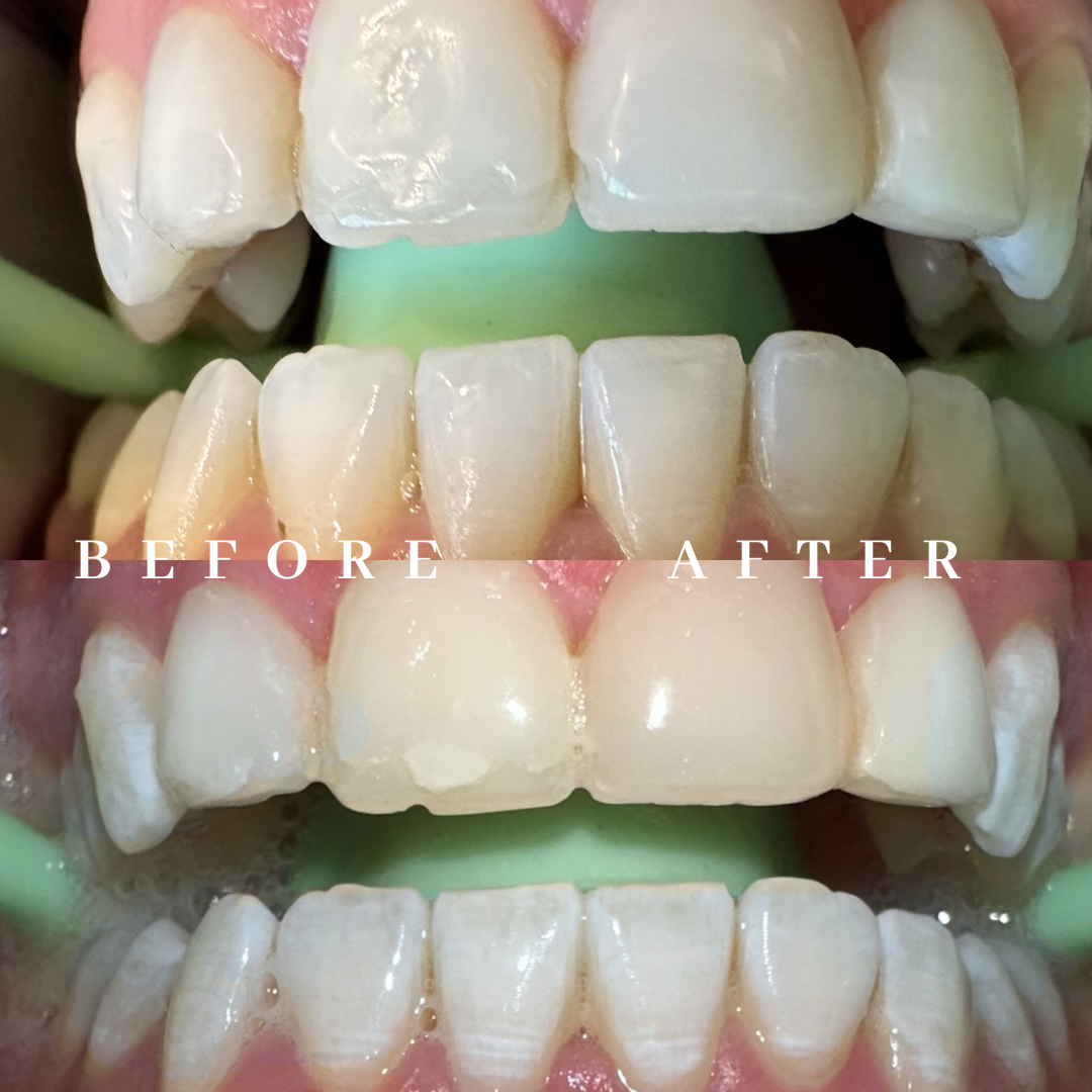 Copy of before & after - 1.png