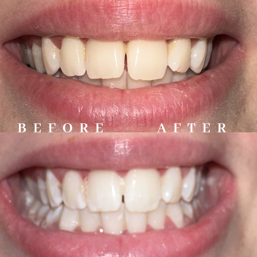 Copy of before & after - 1.png
