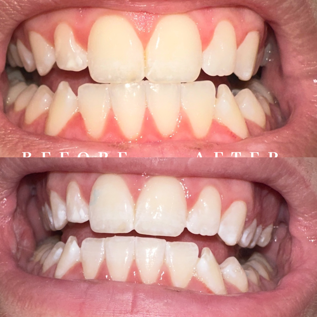 Copy of before & after.png