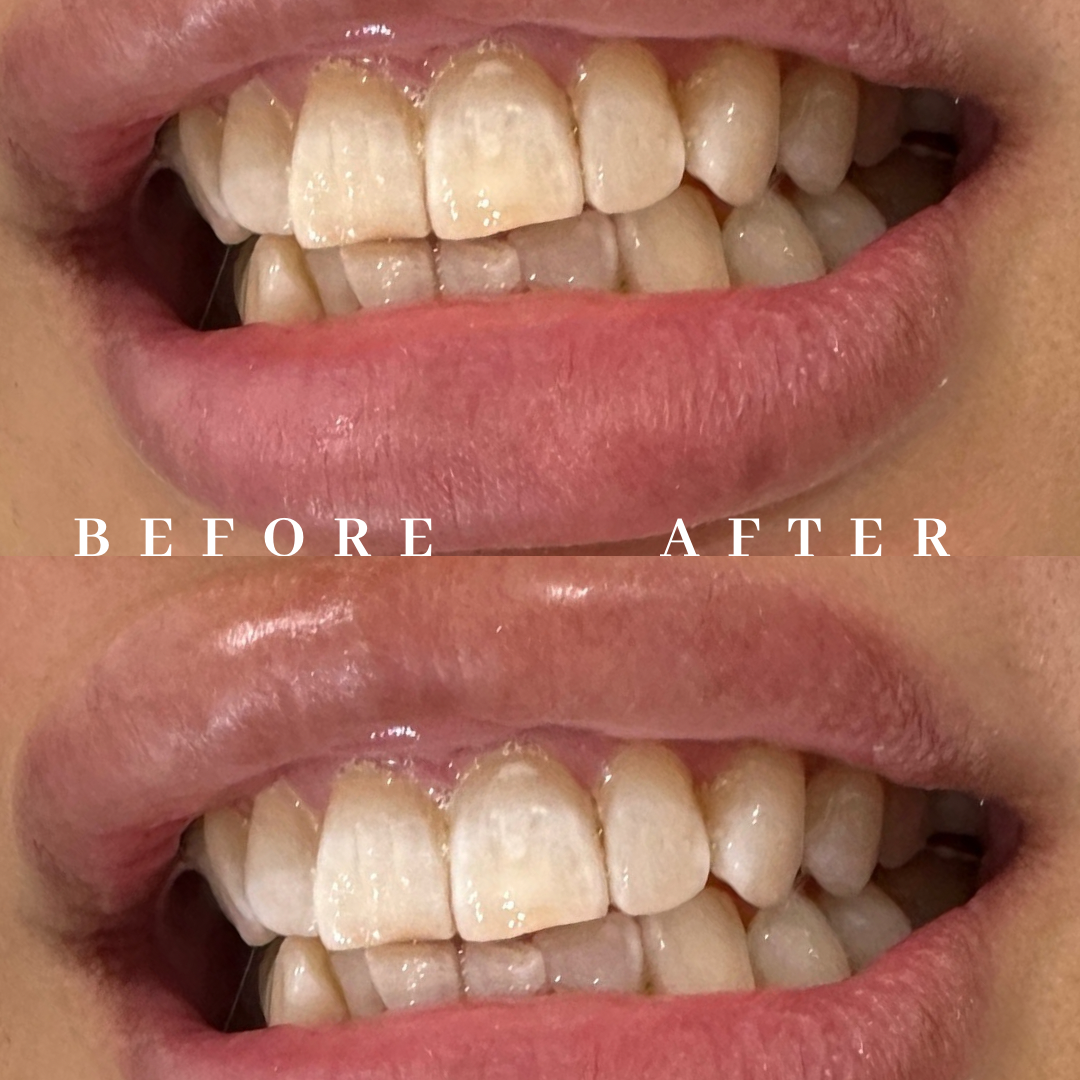 Copy of before & after.png