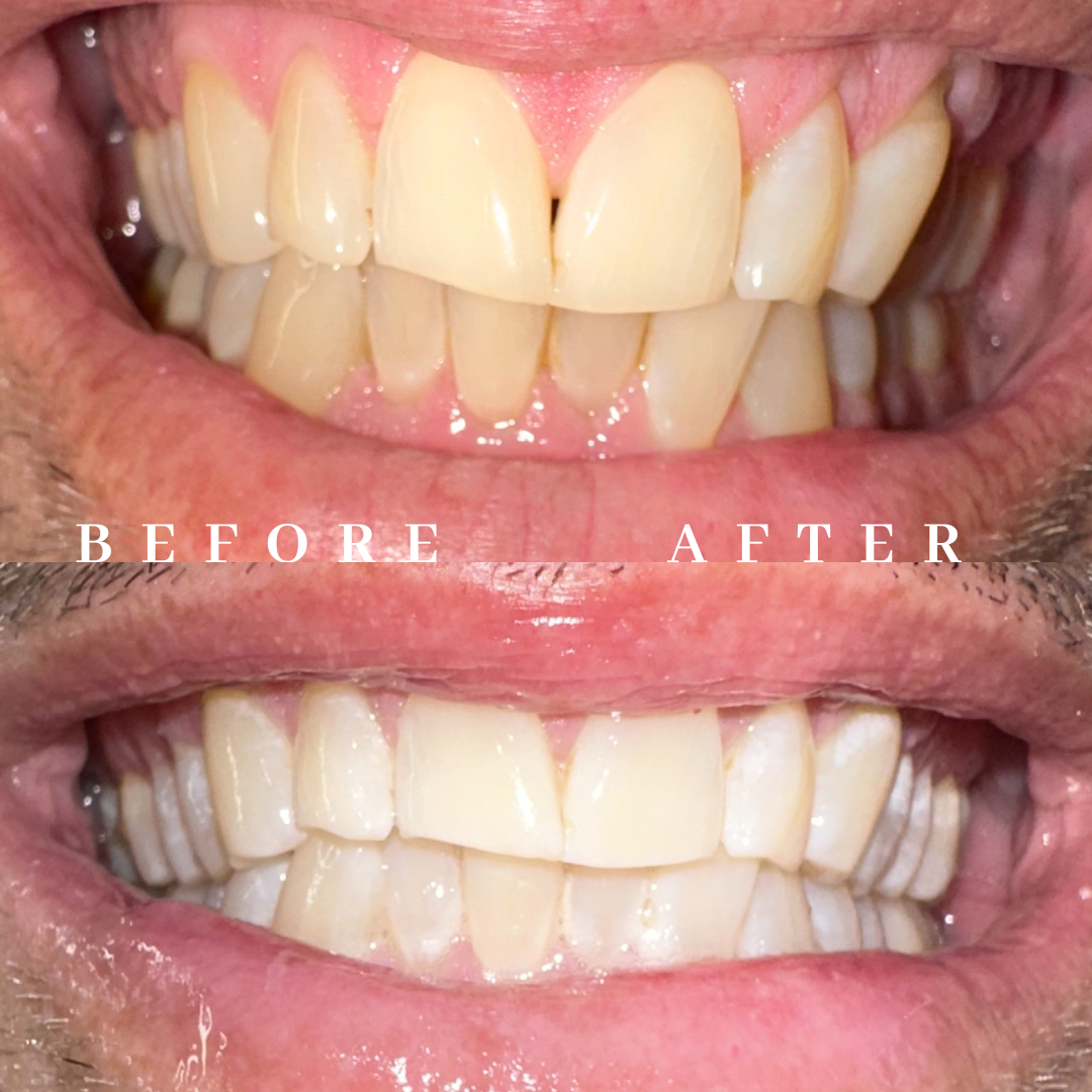 Copy of before & after.png
