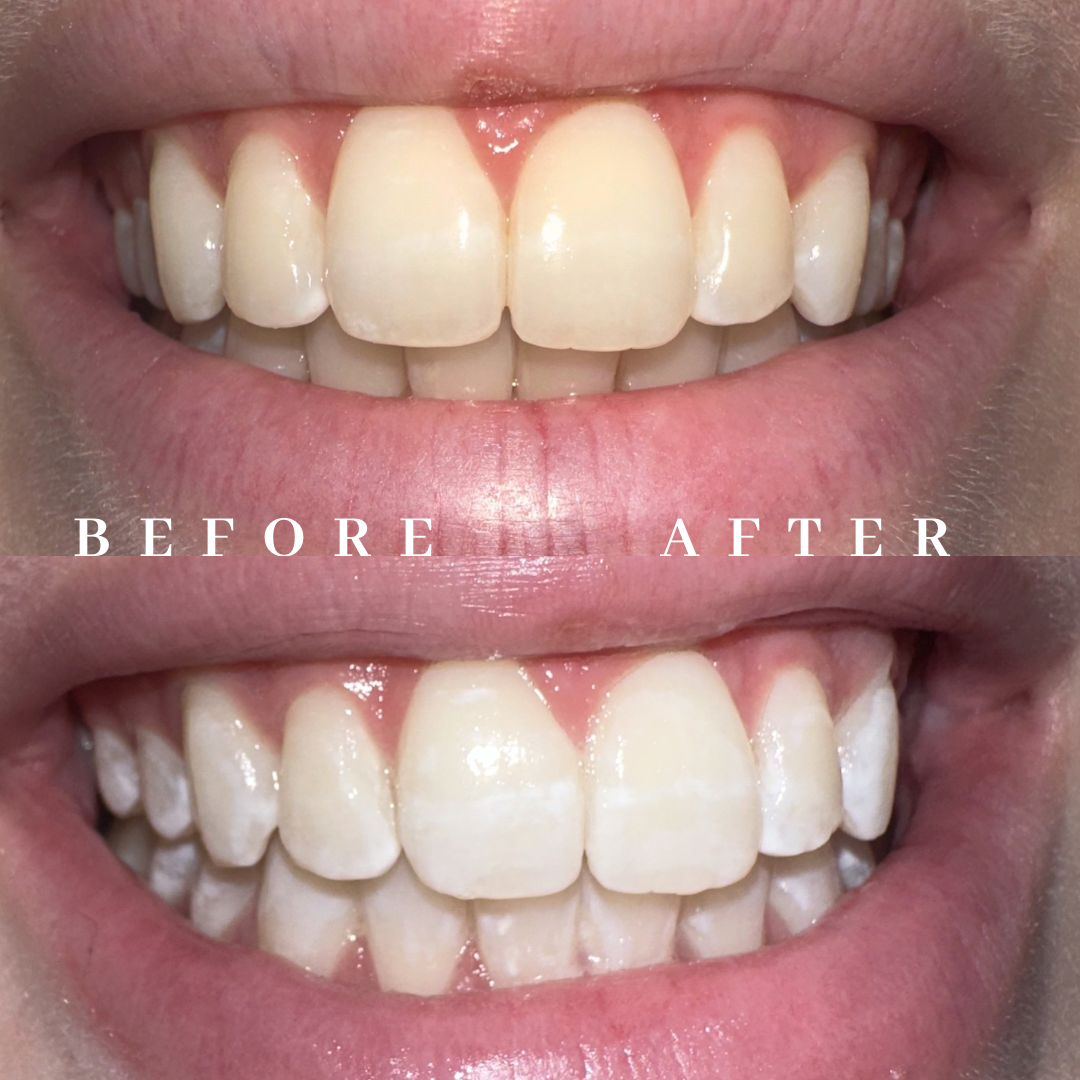 Copy of before & after.png