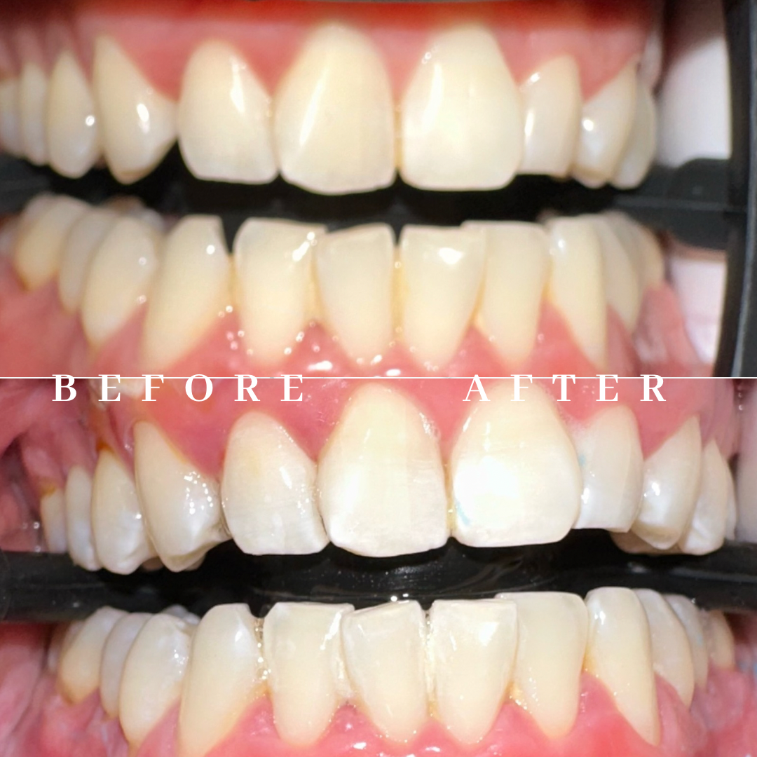 Copy of before & after.png