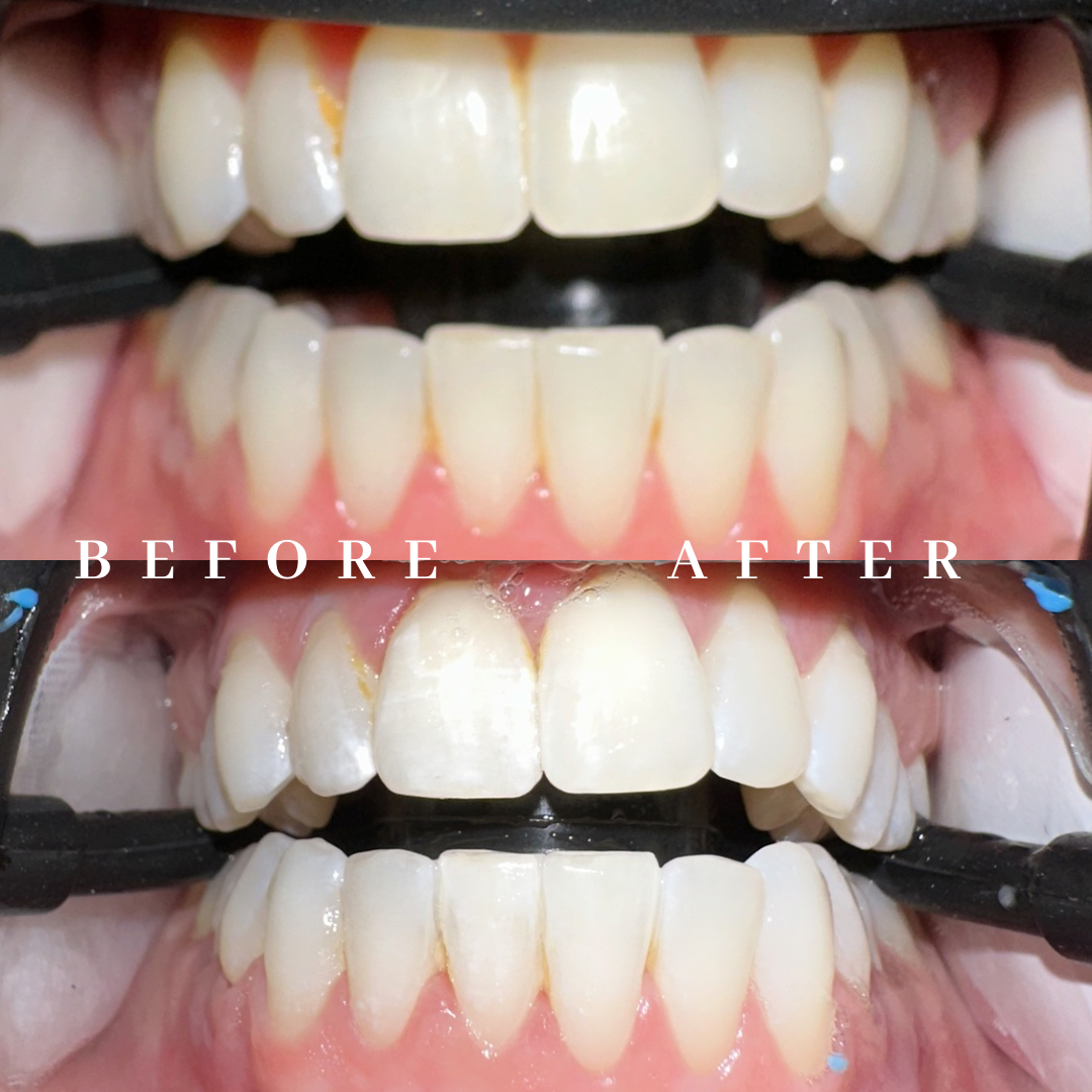 Copy of before & after.png